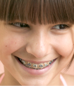 orthodontie appareil dentaire paris 11
