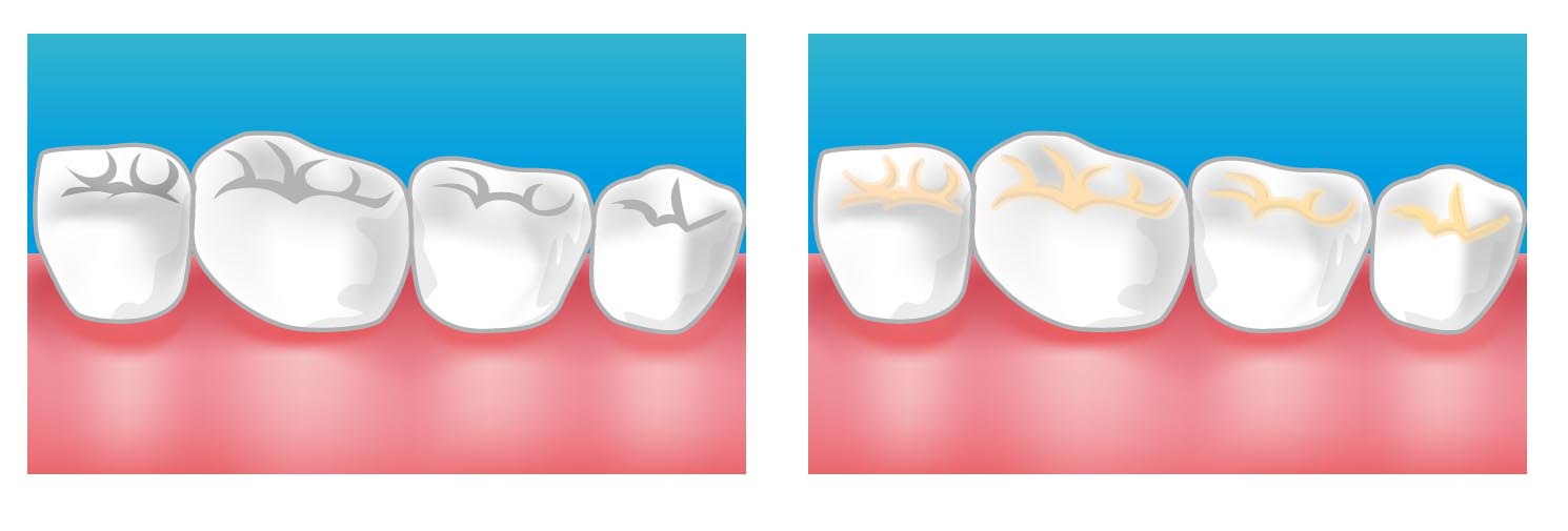 orthodontiste paris 11